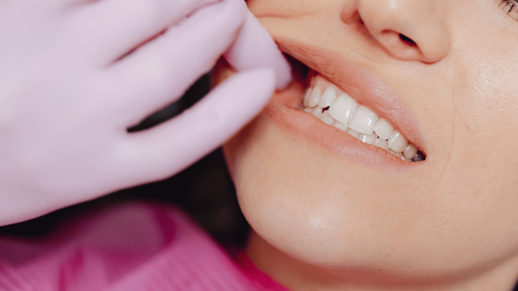 CAMBIO DE COLOR EN EL DIENTE