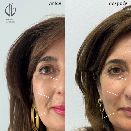 madre-carlota madre-carlota